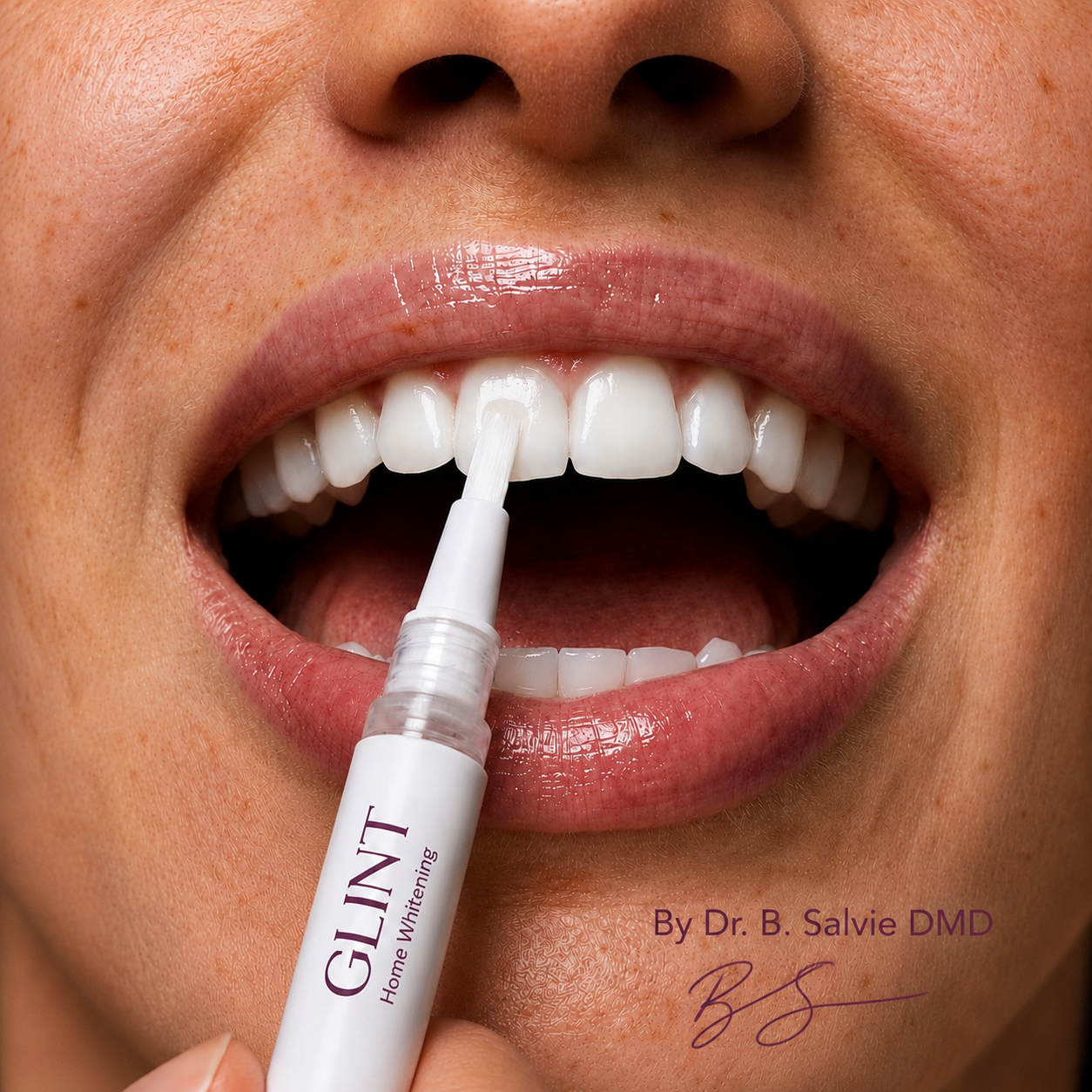 GLINT Home Whitening